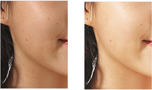 Electric Face Cleansing Brush for Deep Skin Cleaning